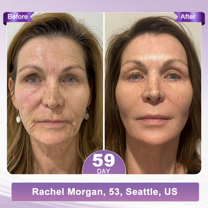1 FDA Official: 🎯𝐇𝐈𝐒𝐊𝐈𝐍® 𝐏𝐃𝐑𝐍 𝐌𝐮𝐥𝐭𝐢-𝐏𝐞𝐩𝐭𝐢𝐝𝐞 𝐌𝐚𝐬𝐬𝐚𝐠𝐢𝐧𝐠 𝐁𝐨𝐝𝐲 𝐑𝐨𝐥𝐥𝐞𝐫 𝐂𝐫𝐞𝐚𝐦- Anti-aging, Hydrating, Skin Firming & Lifting, Skin Repair, Even Tone, Acne and Dark Spot Treatment, Wart and Mole Removal, and Psoriasis Relief.