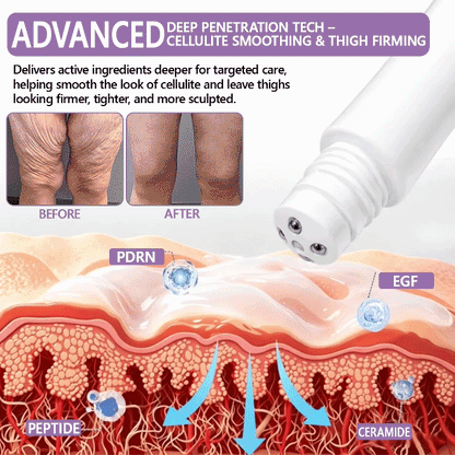 1 FDA Official: 🎯𝐇𝐈𝐒𝐊𝐈𝐍® 𝐏𝐃𝐑𝐍 𝐌𝐮𝐥𝐭𝐢-𝐏𝐞𝐩𝐭𝐢𝐝𝐞 𝐌𝐚𝐬𝐬𝐚𝐠𝐢𝐧𝐠 𝐁𝐨𝐝𝐲 𝐑𝐨𝐥𝐥𝐞𝐫 𝐂𝐫𝐞𝐚𝐦- Anti-aging, Hydrating, Skin Firming & Lifting, Skin Repair, Even Tone, Acne and Dark Spot Treatment, Wart and Mole Removal, and Psoriasis Relief.