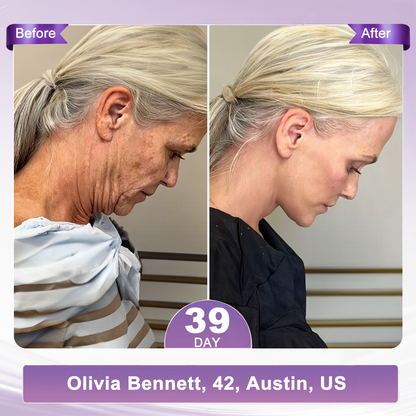 1 FDA Official: 🎯𝐇𝐈𝐒𝐊𝐈𝐍® 𝐏𝐃𝐑𝐍 𝐌𝐮𝐥𝐭𝐢-𝐏𝐞𝐩𝐭𝐢𝐝𝐞 𝐌𝐚𝐬𝐬𝐚𝐠𝐢𝐧𝐠 𝐁𝐨𝐝𝐲 𝐑𝐨𝐥𝐥𝐞𝐫 𝐂𝐫𝐞𝐚𝐦- Anti-aging, Hydrating, Skin Firming & Lifting, Skin Repair, Even Tone, Acne and Dark Spot Treatment, Wart and Mole Removal, and Psoriasis Relief.